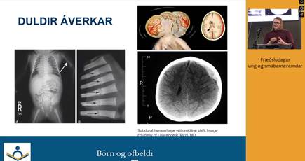 Linkur að Ofbeldi gegn börnum